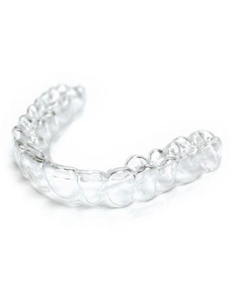 clear aligners